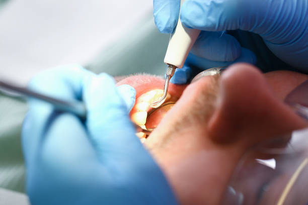 Reliable SD Emergency Dentist Solutions